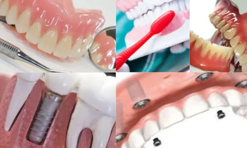 Protetik Diş Tedavisinde Uygulanan Protez Türleri