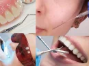 Düzce Diş Teli Fiyatları Seçerken Dikkat Edilmesi Gerekenler