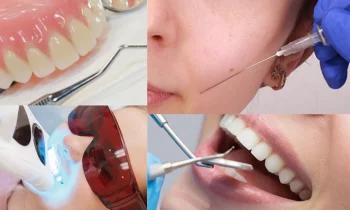 Düzce Diş Teli Fiyatları Seçerken Dikkat Edilmesi Gerekenler