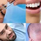Saç Ekimi - Hair Transplant Nerede Yaptırılır?